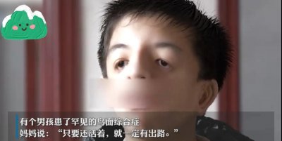 ​男孩患鸟面综合症整张脸看起来像鸟，妈妈:只要活着，就有出路!