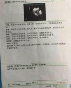 ​女子肿瘤手术做一半发现无肿瘤被迫中止 怒斥医院把手术当儿戏